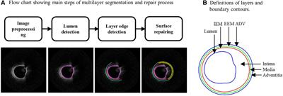 Impact of residual stress on coronary plaque stress/strain calculations using optical coherence tomography image-based multi-layer models